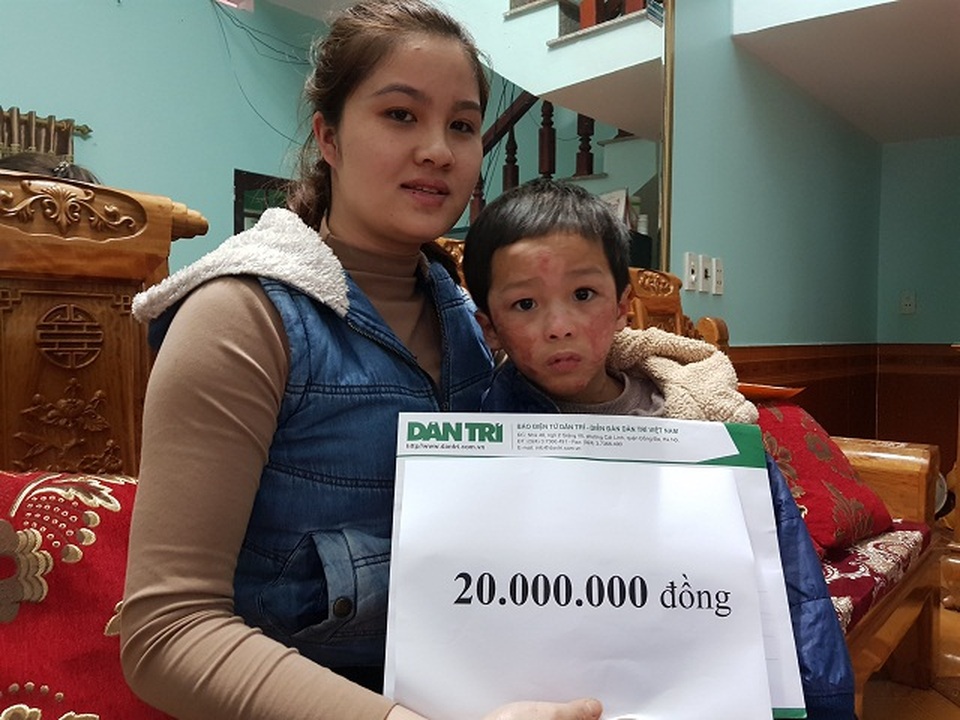 Cậu bé như “ngọn đuốc” trong vụ hoả hoạn tiếp tục được bạn đọc Dân trí giúp đỡ - 4 Cậu bé như “ngọn đuốc” trong vụ hoả hoạn tiếp tục được bạn đọc Dân trí giúp đỡ - 4