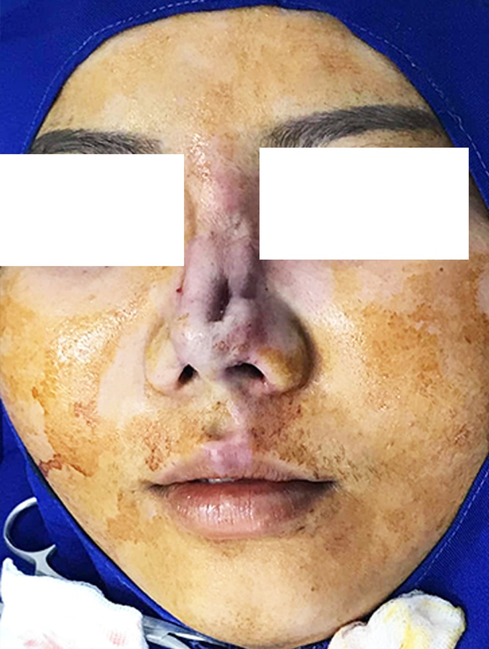 Số phận của những ca phẫu thuật thẩm mỹ mũi hỏng sẽ đi về đâu? - 1 Số phận của những ca phẫu thuật thẩm mỹ mũi hỏng sẽ đi về đâu? - 1