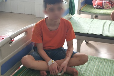 Nữ chủ quán bánh xèo đánh nhân viên bằng chày đá, dao, bàn chải sắt