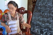 Khởi tố người đàn ông bạo hành vợ tàn nhẫn suốt 11 năm