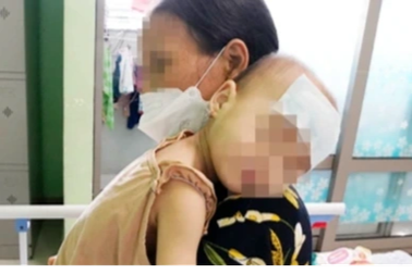 Hai anh em ruột cùng suy thận cấp vì dùng vitamin D quá liều