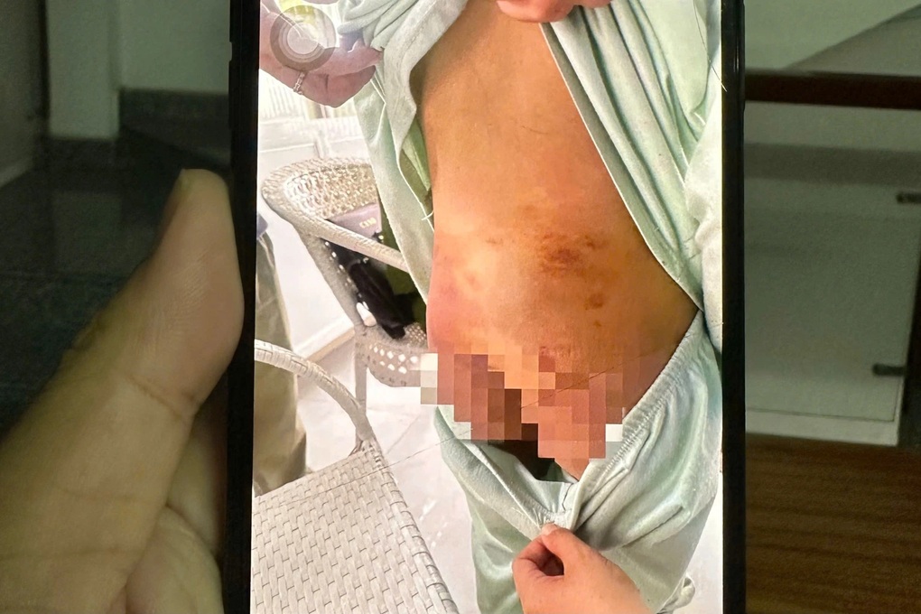 Bắt giam người mẹ và nhân tình bạo hành bé gái 9 tuổi ở TPHCM - 1