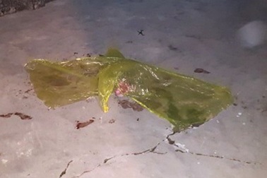 Nghi án mâu thuẫn với vợ, dùng kéo đâm nhầm khiến con gái tử vong