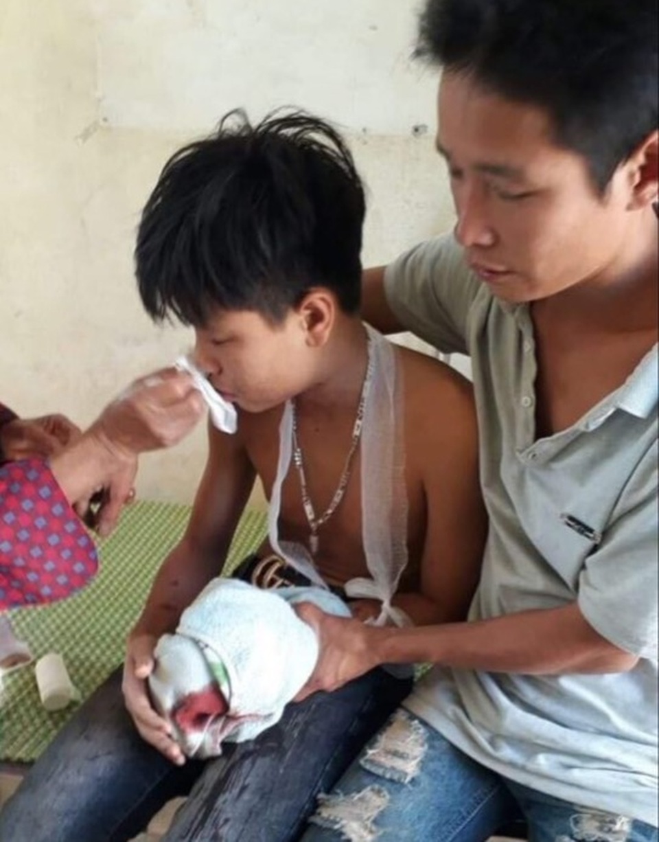 Máy tính xách tay phát nổ, 3 học sinh bị thương - 1 Máy tính xách tay phát nổ, 3 học sinh bị thương - 1