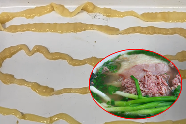 Hà Nội: Thích ăn phở tái, cô gái có sán 6m ngọ nguậy trong người