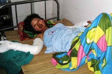 Thai phụ bị chồng thiêu sống ngay sau tuần trăng mật 