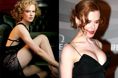 Trẻ đẹp ở tuổi 55, Nicole Kidman nói diễn viên nữ cần "mặt dày"
