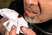 Căn bệnh lâu đời nhất lịch sử khiến hơn 13.000 người Việt chết mỗi năm