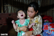 Xót xa bé 4 tuổi viêm phổi, suy gan thận chỉ giảm đau bằng thuốc an thần