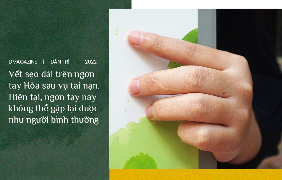 4 ca mổ, 20 chiếc đinh ở chân và nghị lực của nữ sinh khuyết tật - 9 4 ca mổ, 20 chiếc đinh ở chân và nghị lực của nữ sinh khuyết tật - 9