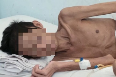 Bắt bệnh nhân ung thư điều trị theo thực dưỡng là độc ác