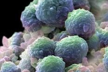 Phương pháp mới chữa ung thư tiền liệt tuyến