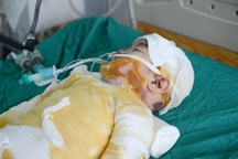 Mẹ bất cẩn, bé 3 tuổi bị bỏng nước sôi toàn thân