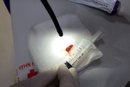 Hy hữu: Mảnh ớt chui tọt vào phế quản bệnh nhân