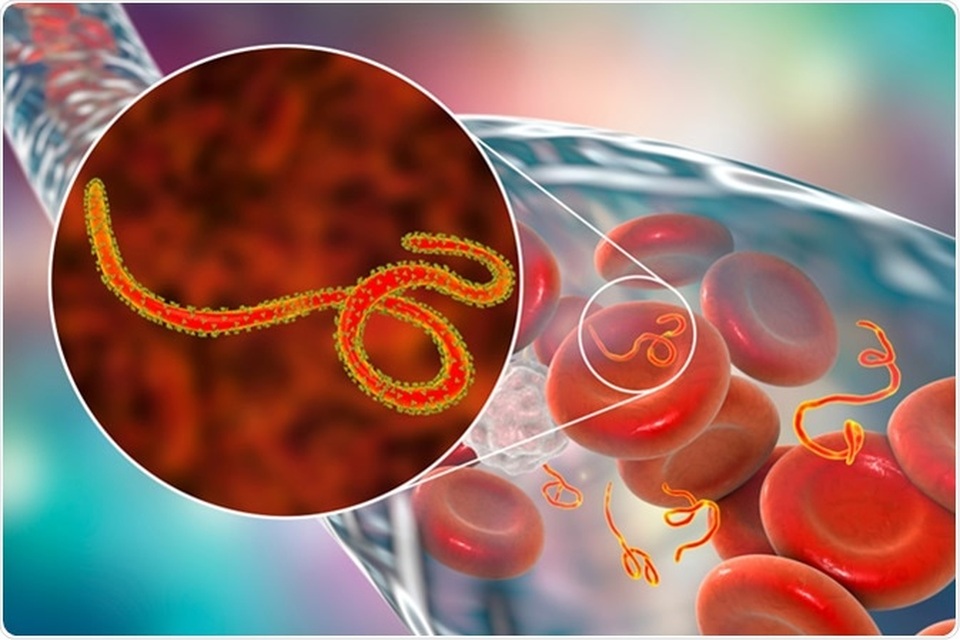Virus Ebola có thể ẩn náu nhiều năm bên trong cơ thể con người - 1 Virus Ebola có thể ẩn náu nhiều năm bên trong cơ thể con người - 1