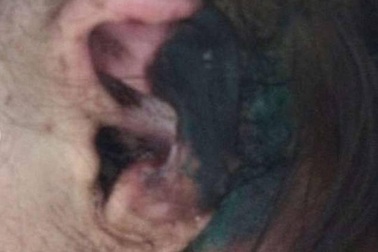 "Bữa tối tình yêu" kinh hoàng với kẻ ăn thịt người bệnh hoạn