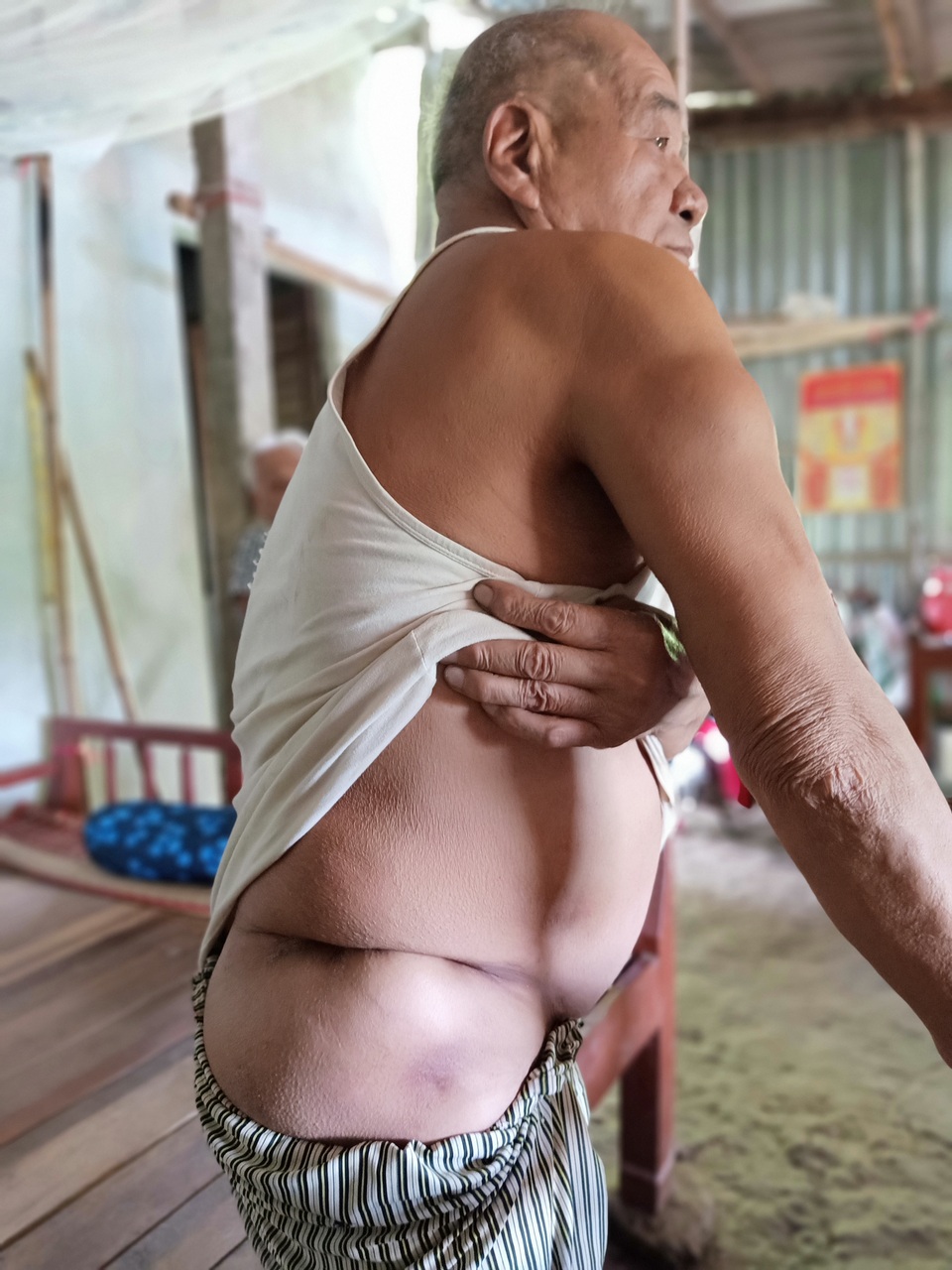Hoàn cảnh đau nhói của người cựu binh với nhiều vết thương chiến tranh - 2 Hoàn cảnh đau nhói của người cựu binh với nhiều vết thương chiến tranh - 2