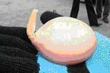 Trứng gà... mọc đuôi