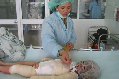 Bạn đọc “thi nhau” chia sẻ nơi chữa bỏng cho cu Lợi