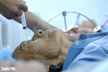 Hàng loạt bệnh viện ở TPHCM ngừng mổ mắt, tuyến cuối dùng sạch thầu cả năm