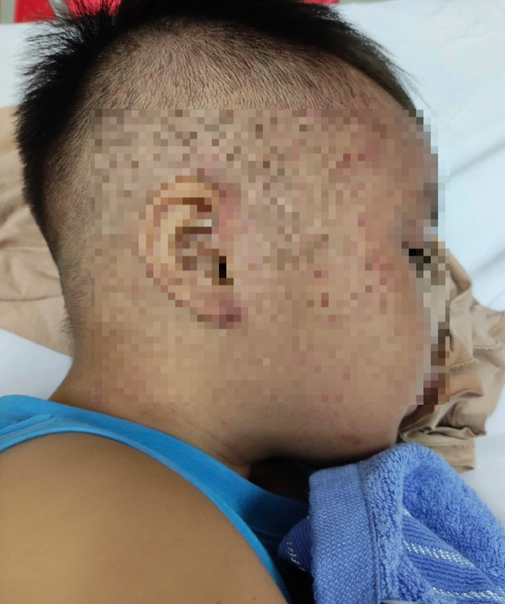 Bé 3 tuổi bị nhốt trong tủ đông vẫn sợ khi gặp người lạ, cần theo dõi sát - 2 Bé 3 tuổi bị nhốt trong tủ đông vẫn sợ khi gặp người lạ, cần theo dõi sát - 2