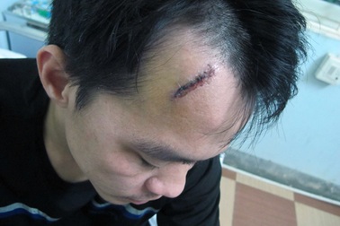 Bị đánh nhầm khi làm “lơ xe”... hộ