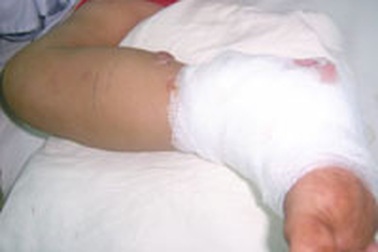 Lại đến mùa rắn độc tấn công người