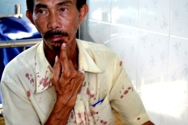 Đánh bảo vệ trường trọng thương vì không nhận học sinh trái tuyến