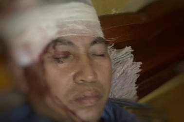 Lái tàu bị ném đá vỡ đầu khi qua Yên Bái