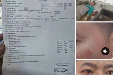 Hiệu trưởng bị tố hành hung giáo viên tại tiệc liên hoan ngày 20/11