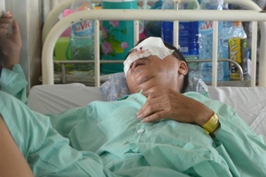 Vụ xe khách bị ném đá: Nạn nhân hỏng hoàn toàn mắt trái