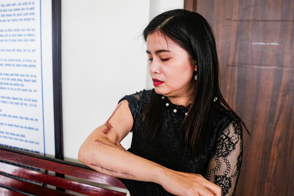 Vụ cháy 56 người chết: Cư dân từng nhiều lần họp bàn tìm cách tự cứu mình - 1 Vụ cháy 56 người chết: Cư dân từng nhiều lần họp bàn tìm cách tự cứu mình - 1