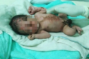 Phát hiện bé trai sơ sinh còn dây rốn bên bờ suối