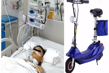 Bé trai bị vỡ thanh quản nguy kịch khi té xe trượt điện