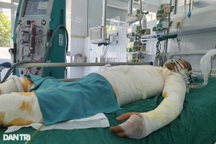 Mẹ già bán ruộng đã cùng kiệt, xin cứu con bị bỏng điện cao thế 50% cơ thể