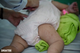 Sở Y tế TPHCM cảnh báo tác nhân gây bệnh truyền nhiễm quay trở lại