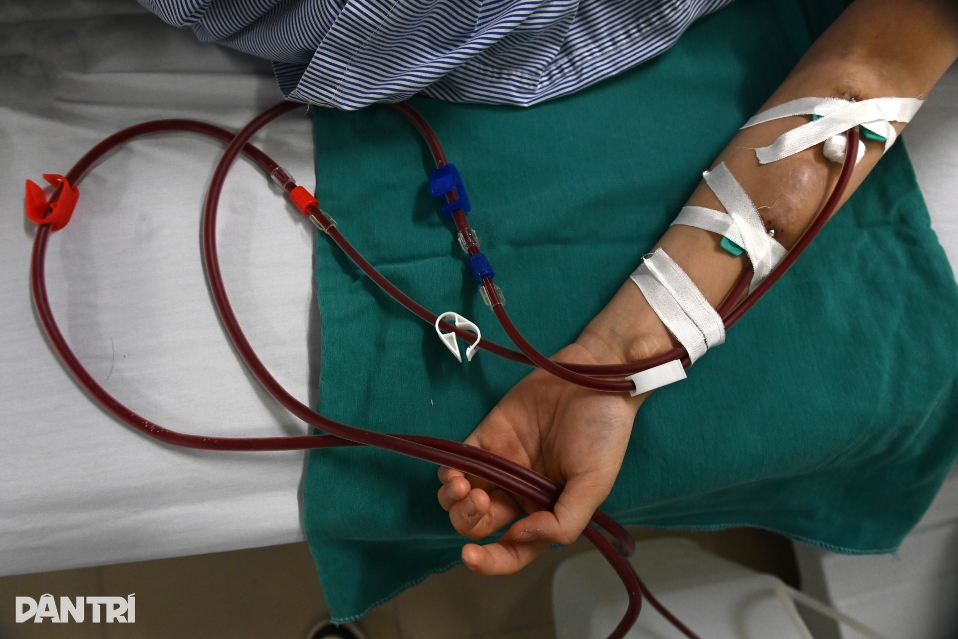 Chưa 30 đã suy thận vì dành cả thanh xuân làm thêm giờ, ăn hàng quán - 3 Chưa 30 đã suy thận vì dành cả thanh xuân làm thêm giờ, ăn hàng quán - 3