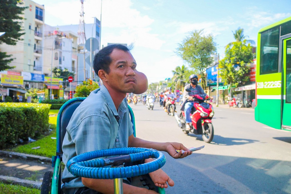 Anh chàng cục bướu bán vé số nuôi người mẹ không máu mủ - 1 Anh chàng cục bướu bán vé số nuôi người mẹ không máu mủ - 1