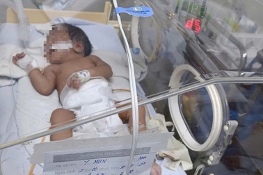 Bé gái 5 ngày tuổi thủng dạ dày vì mẹ cho ăn cơm