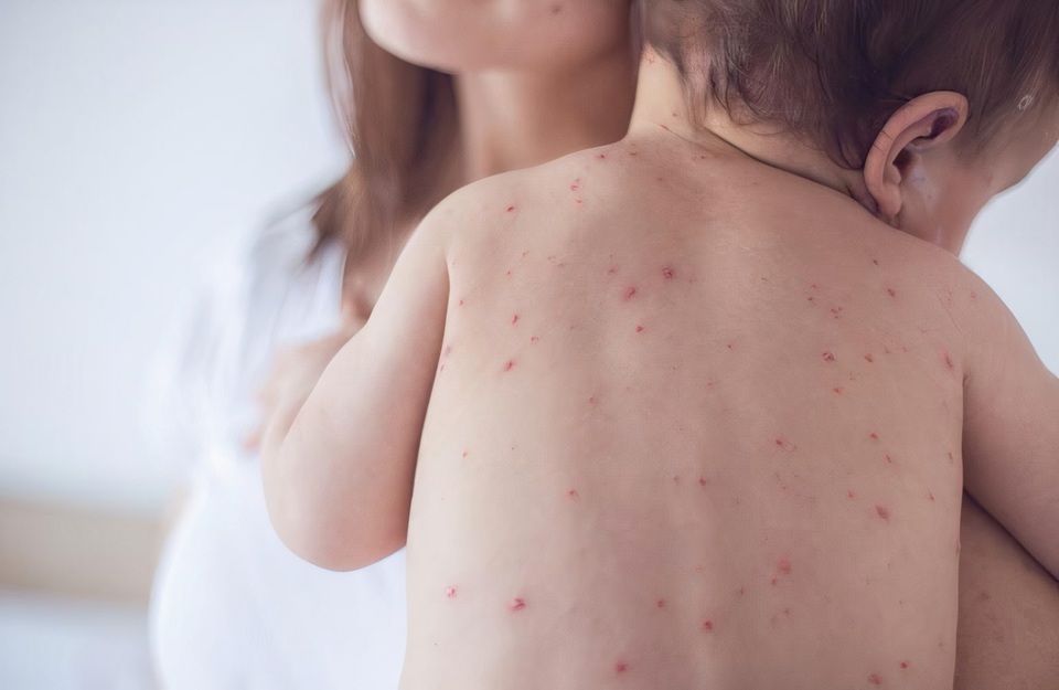 Tác nhân gây bệnh cho trẻ ngay trên quần áo mà bố mẹ không ngờ - 2 Tác nhân gây bệnh cho trẻ ngay trên quần áo mà bố mẹ không ngờ - 2