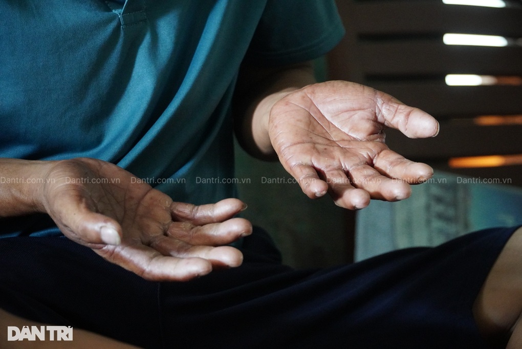 Bố ung thư, gia đình lâm cảnh khốn cùng, 2 con nguy cơ bỏ học - 2 Bố ung thư, gia đình lâm cảnh khốn cùng, 2 con nguy cơ bỏ học - 2