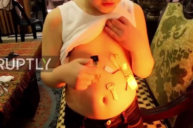 Cậu bé có khả năng hút kim loại như nam châm