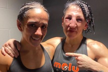 Nữ võ sĩ biến dạng khuôn mặt sau khi nhận... 236 cú đấm của đối thủ