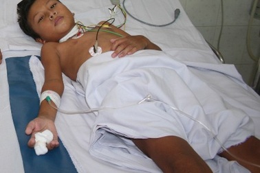 Cụt ngón tay vì bị rắn cạp nia cắn