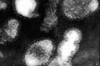 Số người chết vì bệnh lạ ở Tứ Xuyên tăng nhanh