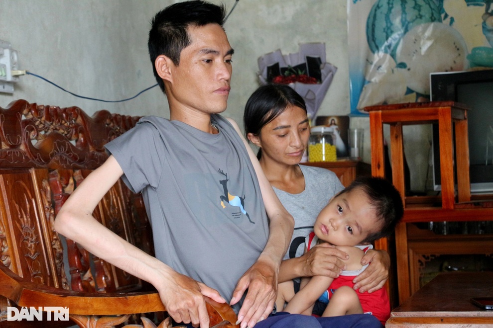 Bố tật nguyền, mẹ thiểu năng, thương bé trai 4 tuổi mắc bệnh hiểm nghèo - 3 Bố tật nguyền, mẹ thiểu năng, thương bé trai 4 tuổi mắc bệnh hiểm nghèo - 3