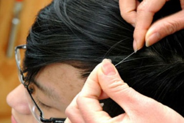 Thức khuya, căng thẳng… nên ta bạc đầu? 