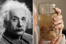 Bộ não của Einstein có gì đặc biệt mà bị cướp "trắng trợn" khi ông qua đời?