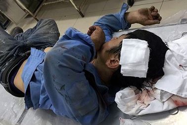 Hà Nội: Điều tra nghi án thuê côn đồ chém người, “dằn mặt” đối thủ