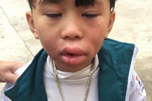 Một bé trai nghi bị ngộ độc sau khi ăn kẹo ở cổng trường